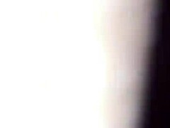 Doctor applies chocolate glaze to patient in hospital.