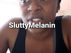 Penile Yeast Infection in Ebony Milf Examined Closely